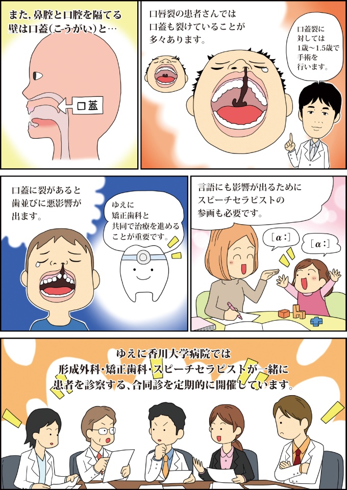 漫画で解説~口唇裂・口蓋裂の治療|診療案内|香川大学医学部 漫画で解説~口唇裂・口蓋裂の治療|診療案内|香川大学医学部