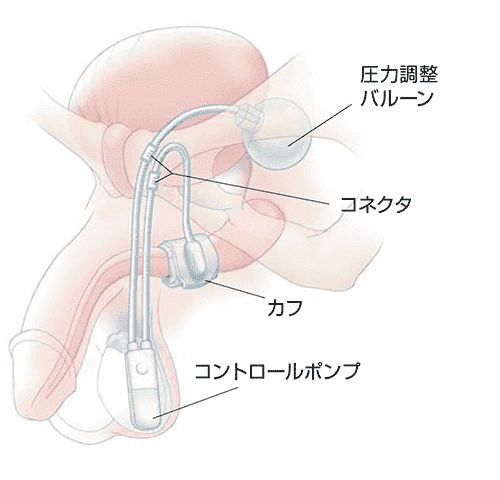 括約筋 肛門の構造 | マルホ 医療関係者向けサイト
