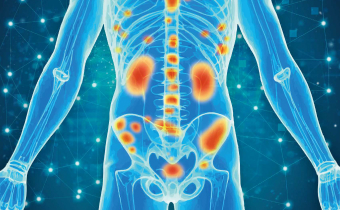 PSMA PETとPSMAリガンド療法